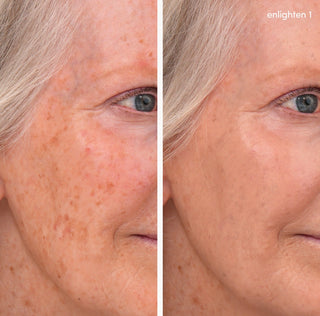 Enlighten Concealer